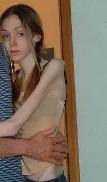 Skinny anorexic girls pussy