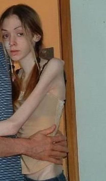 pussy girls Skinny anorexic