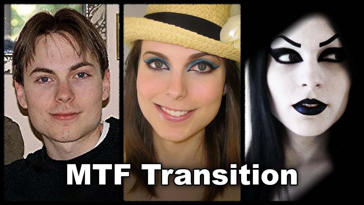 Transgender woman before and after surgery